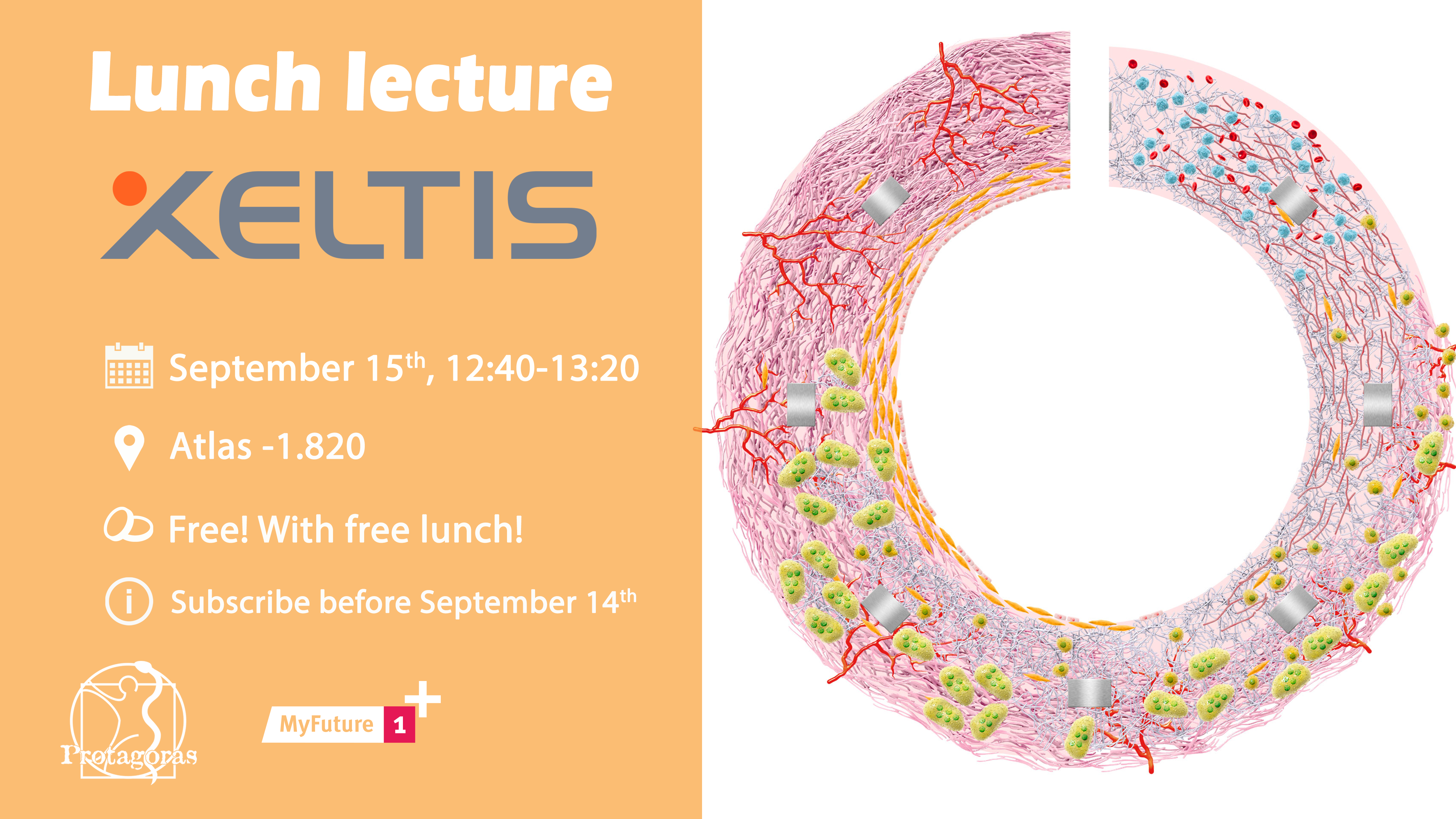 Xeltis lunch lecture
